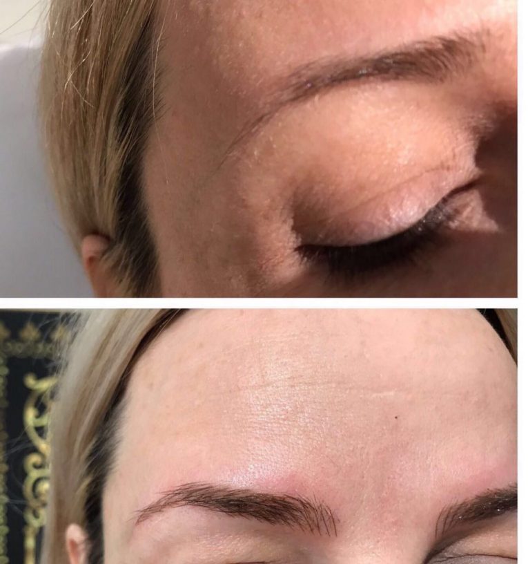 Microblading